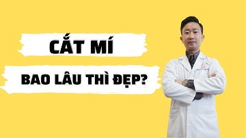 Cắt mí bao lâu thì đẹp? Bác sỹ Tuấn Dương
