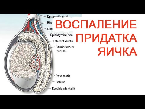 Воспаление придатка яичкам / Доктор Черепанов