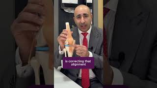 Benefits Of Knee Osteotomy For Arthritis - Osteoarthritis Knee Treatment - New Victoria Hospital