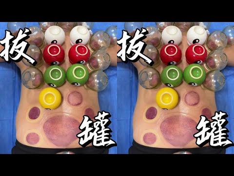 bor~bor~bor~ 沉浸式解压拔罐。内容仅供参考，如有不适请线下就医。#解压 #治愈系拔火罐 #拔罐 #男人减速带 #放松解压