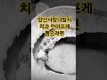 양산사랑니발치 치과 안아프게 뽑으려면 매복사랑니발치