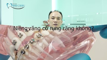 Tại Sao Giá Niềng RĂng Khác Nhau| Niềng Răng Cần Ăn Gì?