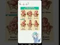 Types of Fetal malpresention#gynecologist#nursing #ytshorts