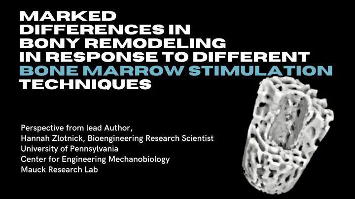 Discussion of the Effects of Bone Marrow Stimulati...