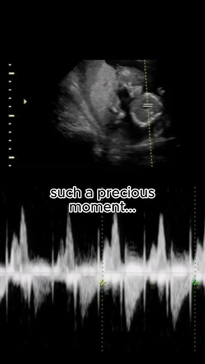 That Tiny Heartbeat Isn t Just A Sound It s The Rhythm Of Your Heart s the-dells-stay-in-my-corner-louis-satterfield-on-bass-world-s