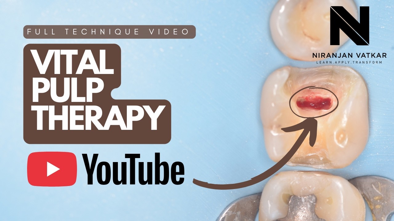 Vital Pulp Therapy - YouTube