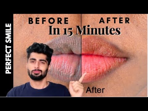 TIPS FOR PHOTOGENIC SMILE IN 15 MINUTES | Get Red Lips & Whiten Your Teeth Naturally | MRIDUL MADHOK