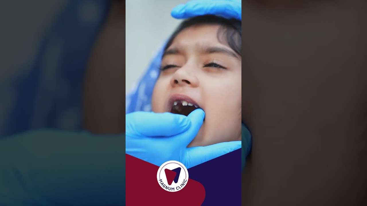Why do kids need space maintainers these little devices are crucial for keeping a child’s teeth