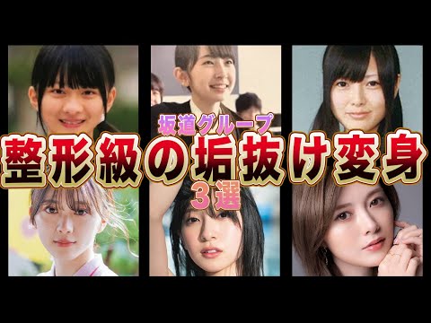 【3坂道】整形級に垢抜けたメンバー３選(白石麻衣,森田ひかる,金村美玖)【乃木坂46・欅坂46・けやき坂46】