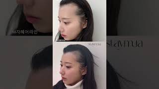 M자탈모 극복 #헤어라인문신 #자연눈썹 #두피문신 #인천두피문신