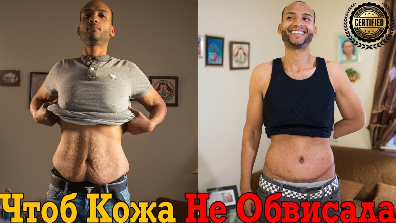 Лучше добавки для подтяжки кожи без операции!