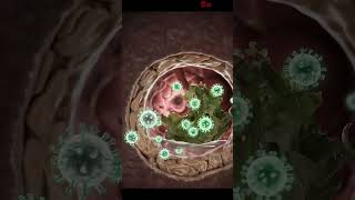 Lassa Fever and The Chef (human body)