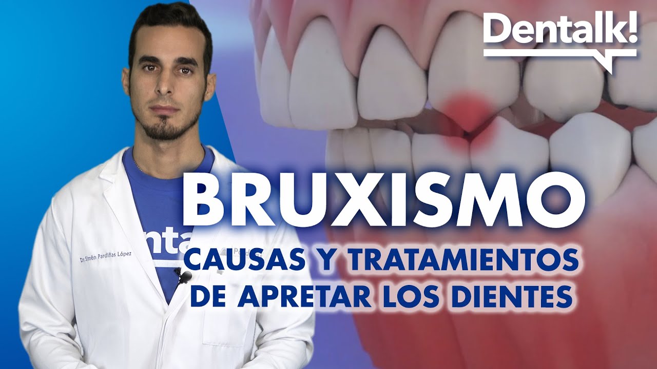 Aprieto los Dientes por la Noche ¿Tengo Bruxismo?