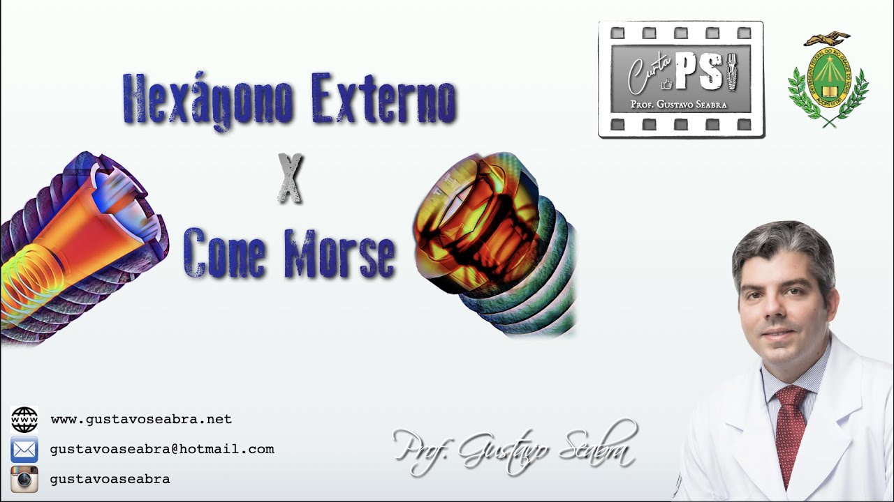 Curta PSI - Como selecionar implantes Cone Morse e Hexágono externo?