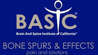 BasicSpine.com - Dr. Ty and Bone Spurs & Minimally Invasive Treatments