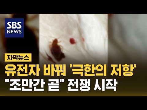 곧 긴급 승인하는데...벌써부터 감지된 저항 (자막뉴스) / SBS