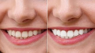 Photoshop Tutorial : How to Whiten & Brighten Teeth [Photoshopdesire.com] screenshot 5