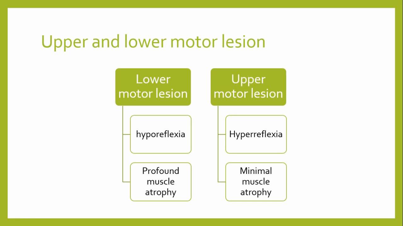 Upper Vs Lower Motor Neuron Signs