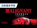 映画『マリグナント 狂暴な悪夢』日本版本予告 2021年11月12日（金）公開