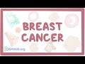 Breast cancer - causes, symptoms, diagnosis, treatment, pathology