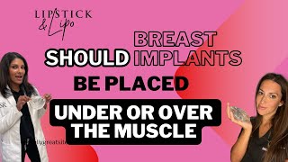 Should breast implants be placed above or below the muscle?