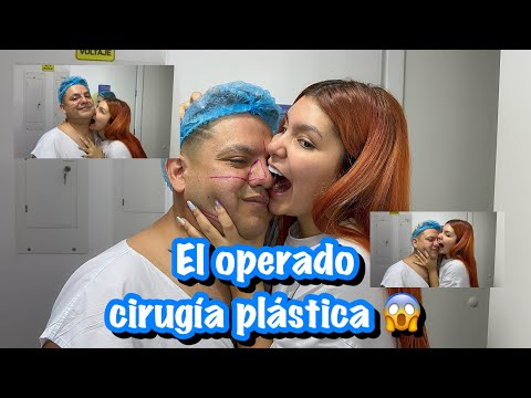 SU OPERACIÓN ESTÉTICA (CAMBIO EXTREMO 😳PERO ALGO SALIO MAL😭