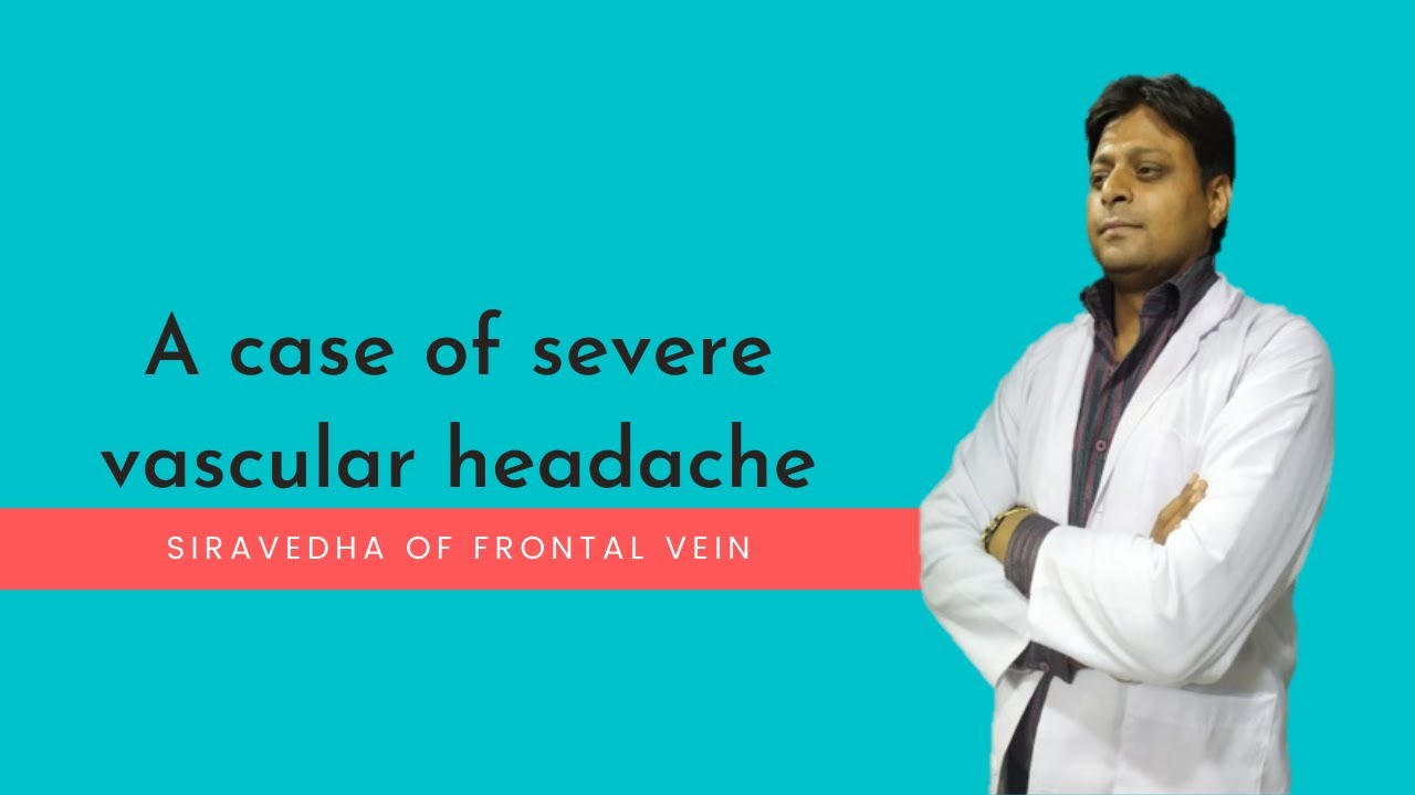 A case of severe vascular headache YouTube