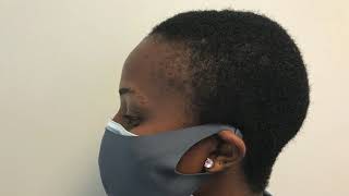 Fort Lauderdale Hair Transplant Clinic | Ft. Lauderdale Hair Transplant Traction Alopecia Surgery