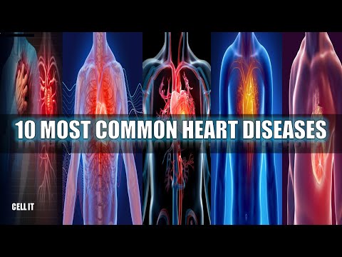 10 Most Common Heart Diseases You Need To Know