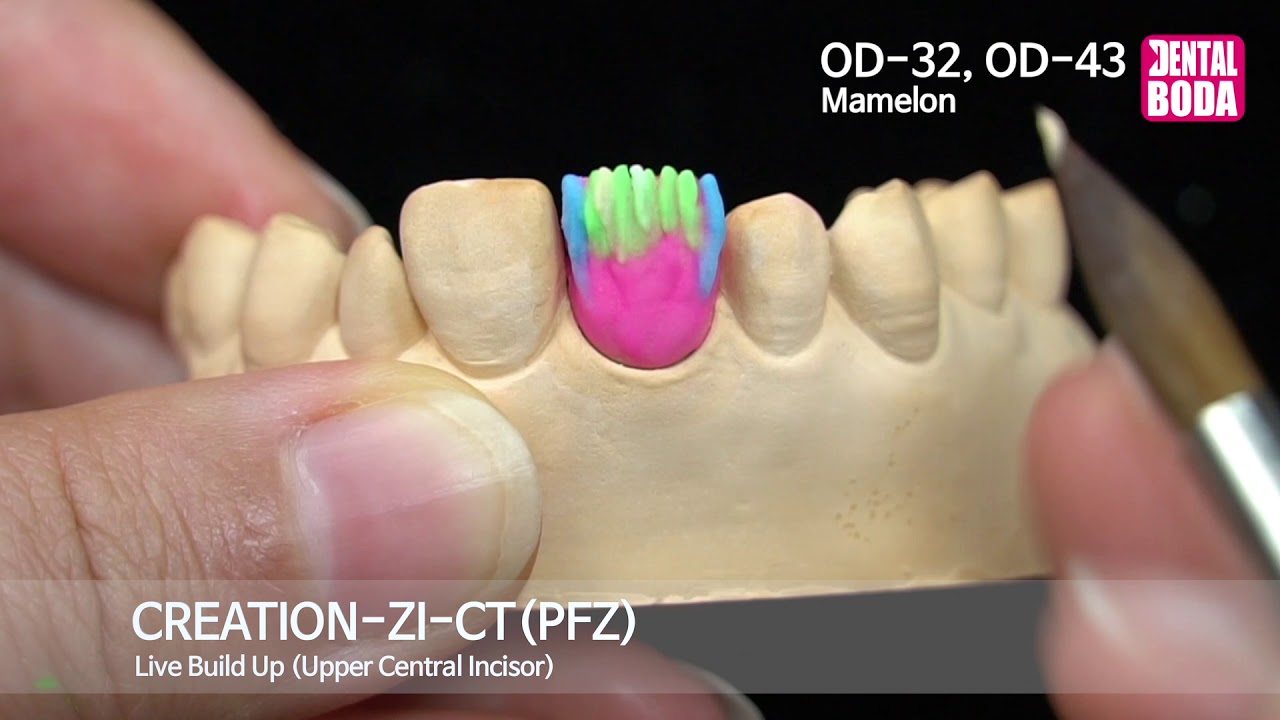 Creation ZI-CT (PFZ)