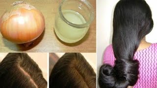 How to use ginger and onion for Unstoppable Hair growth