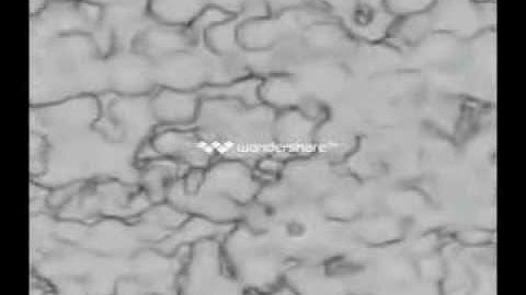 Dr. Pavelic Invents the Ti Foam Dental Implant System