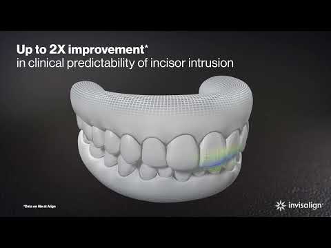 Invisalign® G8 |