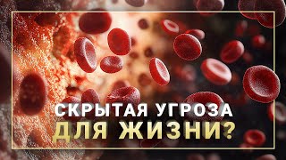 Чем опасна густая кровь и нехватка кислорода?