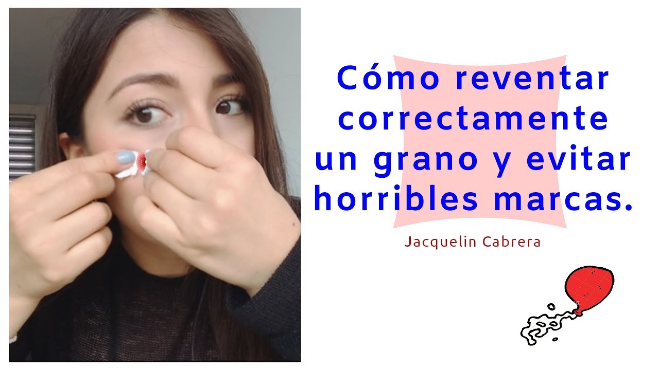 COMO QUITAR UN GRANO SIN DEJAR MARCA JacquelinCabrera YouTube