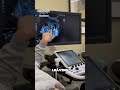Students Scanning Friend Discovered THIS on Ultrasound! 🤯😱 #shorts #shortvideo