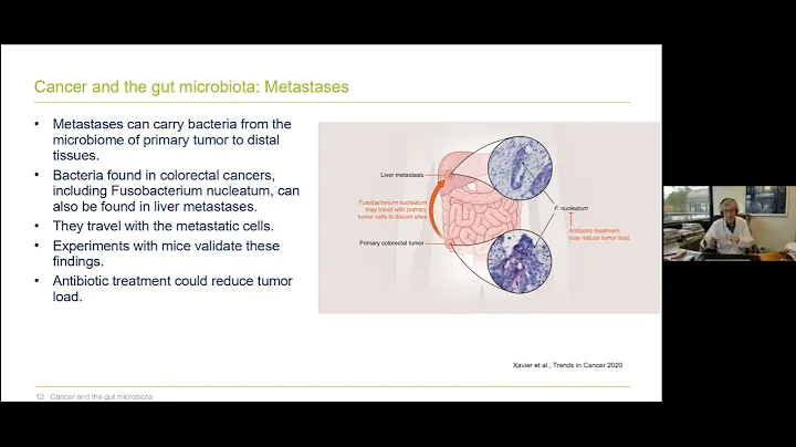 Webinar Recording | Understanding the Human Microbiome: Cancer & the Gut microbiome - DayDayNews