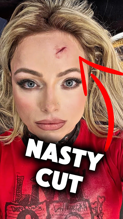 Liv Morgan SUFFERED A NASTY CUT On Raw 😱
