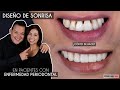 Diseño de Sonrisa en pacientes con Enfermedad Periodontal ¿Cómo se hace? - Odontología Láser.