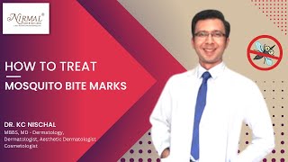 How To Treat Black Marks After Mosquito Bites By Dr K.c Nischal
