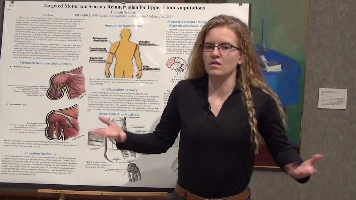 Student Research: Hannah Schmidt '20 Studies Amput...
