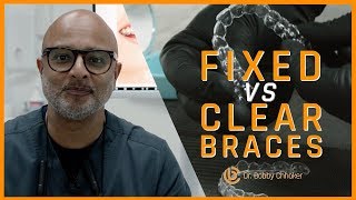 Clear Braces or Fixed Braces? - In The Chair With Dr. Bobby Chhoker