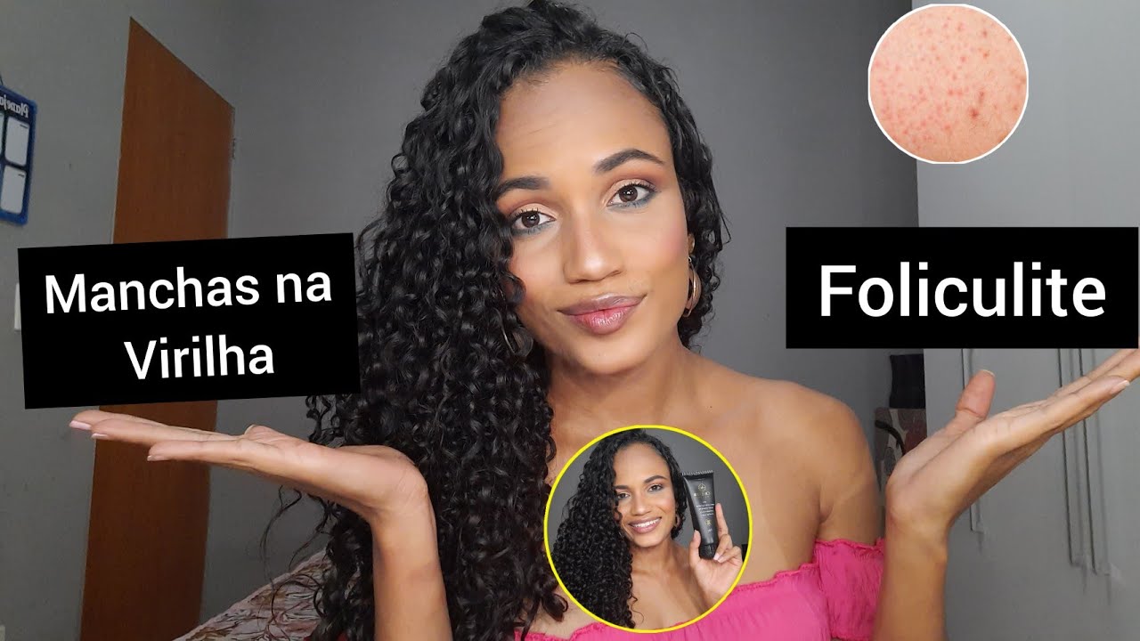 COMO ACABAR COM A FOLICULITE E MANCHAS NA VIRILHA USANDO FOLIPRO| Maary ...