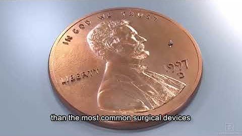 MIGS The iStent Inject with subtitles