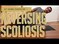 Scoliosis is REVERSIBLE! Back Pain Exercises - Side Plank For Reversing Scoliosis