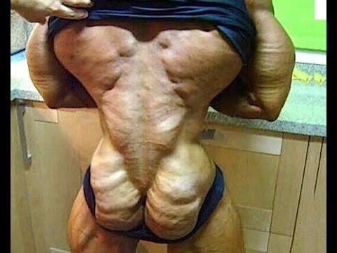 Side effect of steroids in men