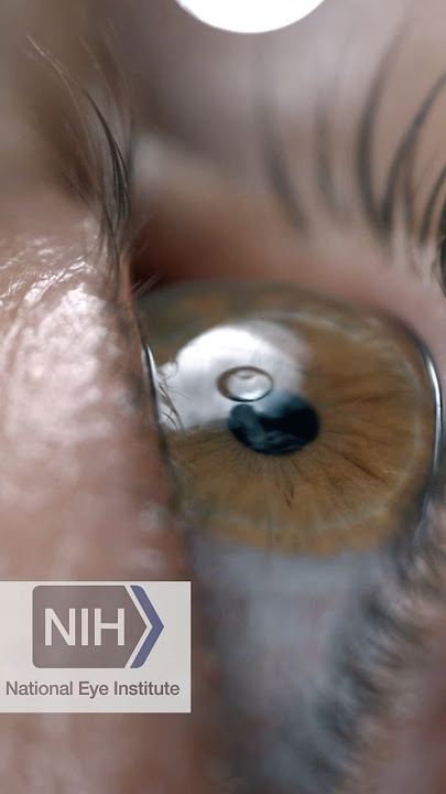 Eye drops for AMD?