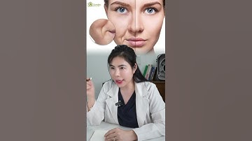 Lý Do Có Rãnh Cười Sâu Hay Rãnh Mũi Má Sâu Làm Già Hơn 3 Đến 5 Tuổi & Cách Xử Lý