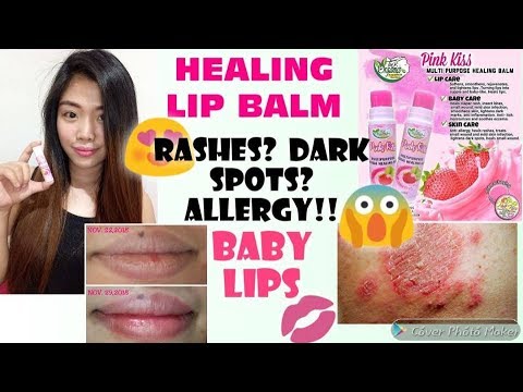 best-lip-balm-for-dry-lips-|-pink-kiss-multi-purpose-healing-balm