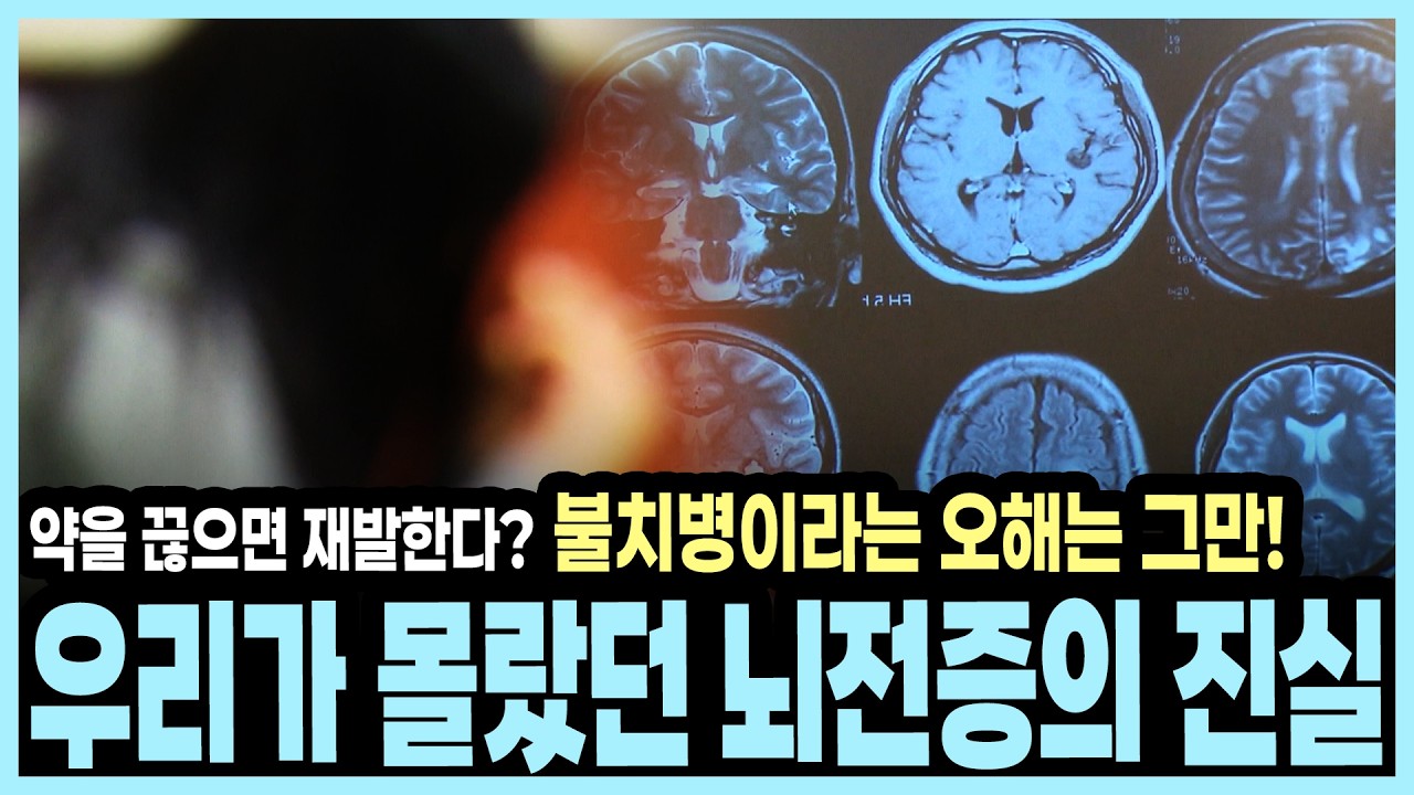 정확한 원인 3분의 1밖에 모르는 뇌전증, 완치 가능한가? I KBS 알약톡톡 20131028 방송